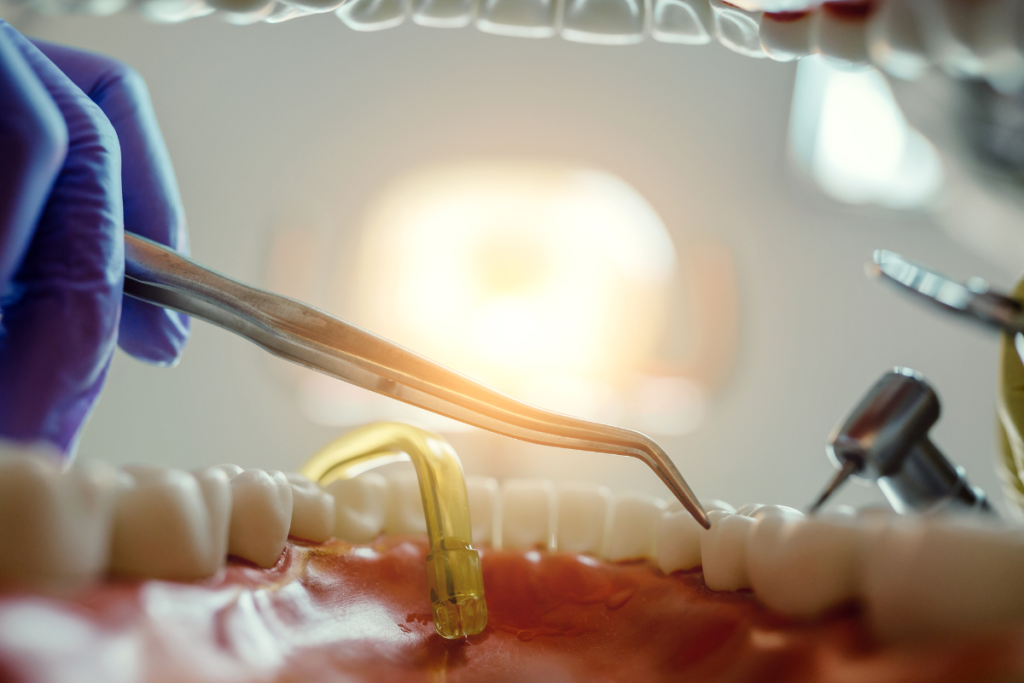 Le bilan dentaire du sportif : enjeux et prévention