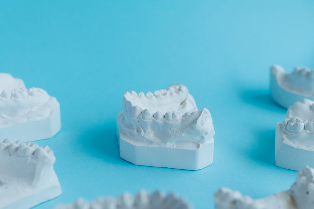 Comprendre et résoudre les troubles de l'occlusion : plongée dans les symptômes, causes et solutions